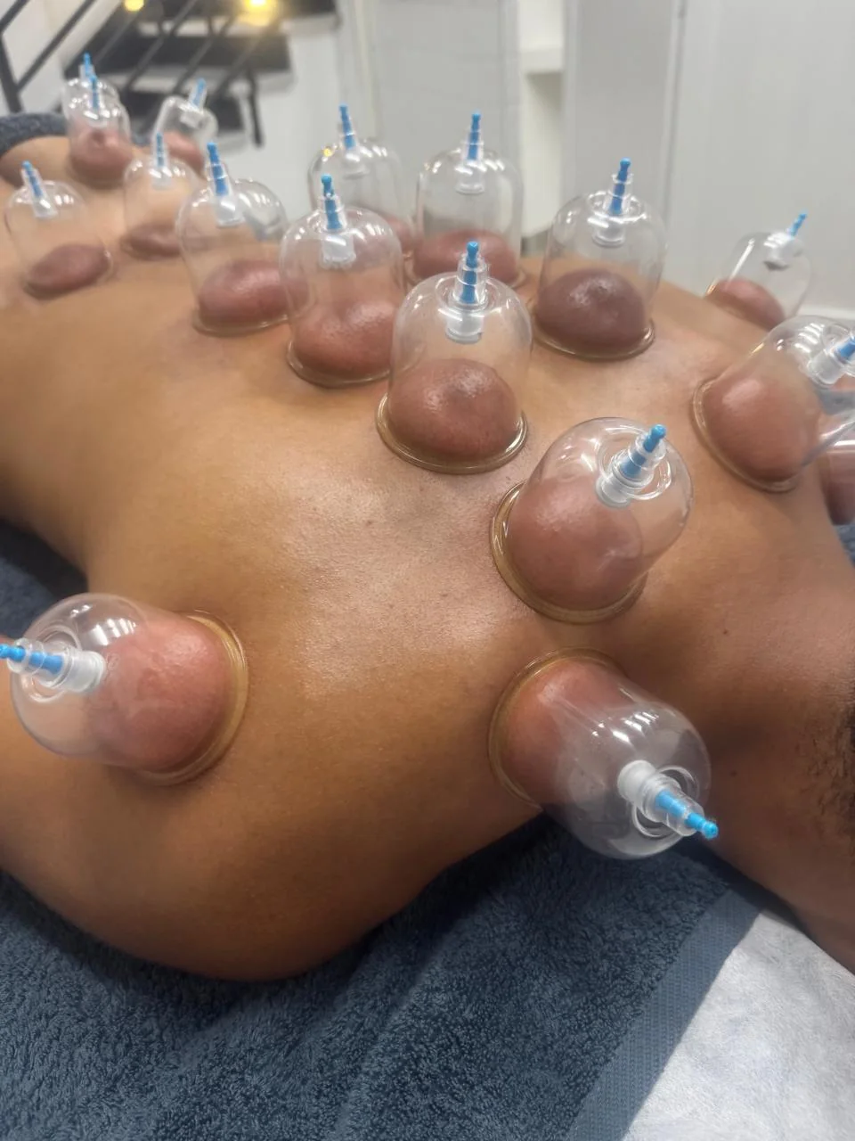 Detox massage and back cupping session
